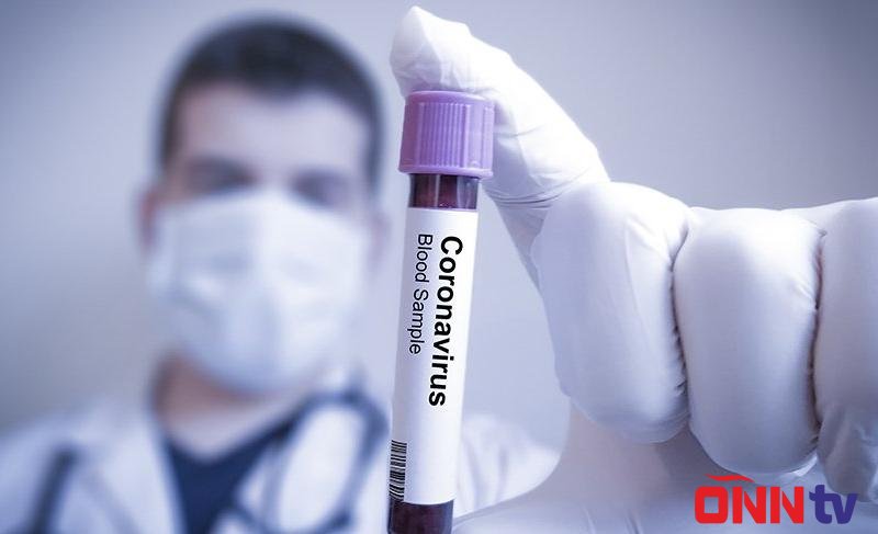 Azərbaycanda daha 3705 nəfər koronavirusa yoluxdu, 42 nəfər öldü