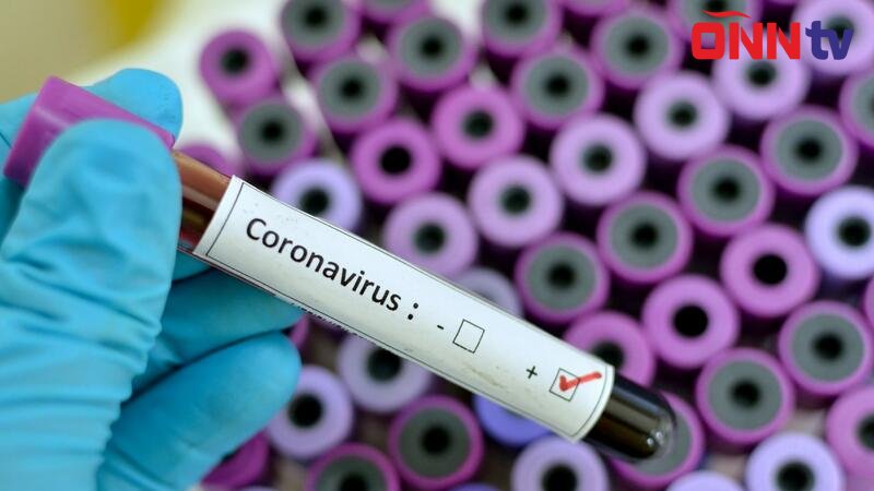 Koronavirusa yoluxma sayı KƏSKİN ARTDI